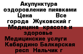 Акупунктура, оздоровление пиявками › Цена ­ 3 000 - Все города, Жуковский г. Медицина, красота и здоровье » Медицинские услуги   . Кабардино-Балкарская респ.,Нальчик г.